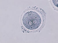 顆粒膜細胞